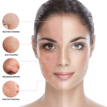Dispositivo de Belleza para el Cuidado de la Piel con LED Fotón RF Facial para el Hogar.