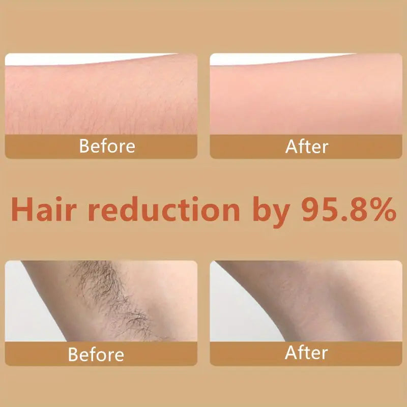 Epilador de Cristal Sin Dolor para Hombres y Mujeres
