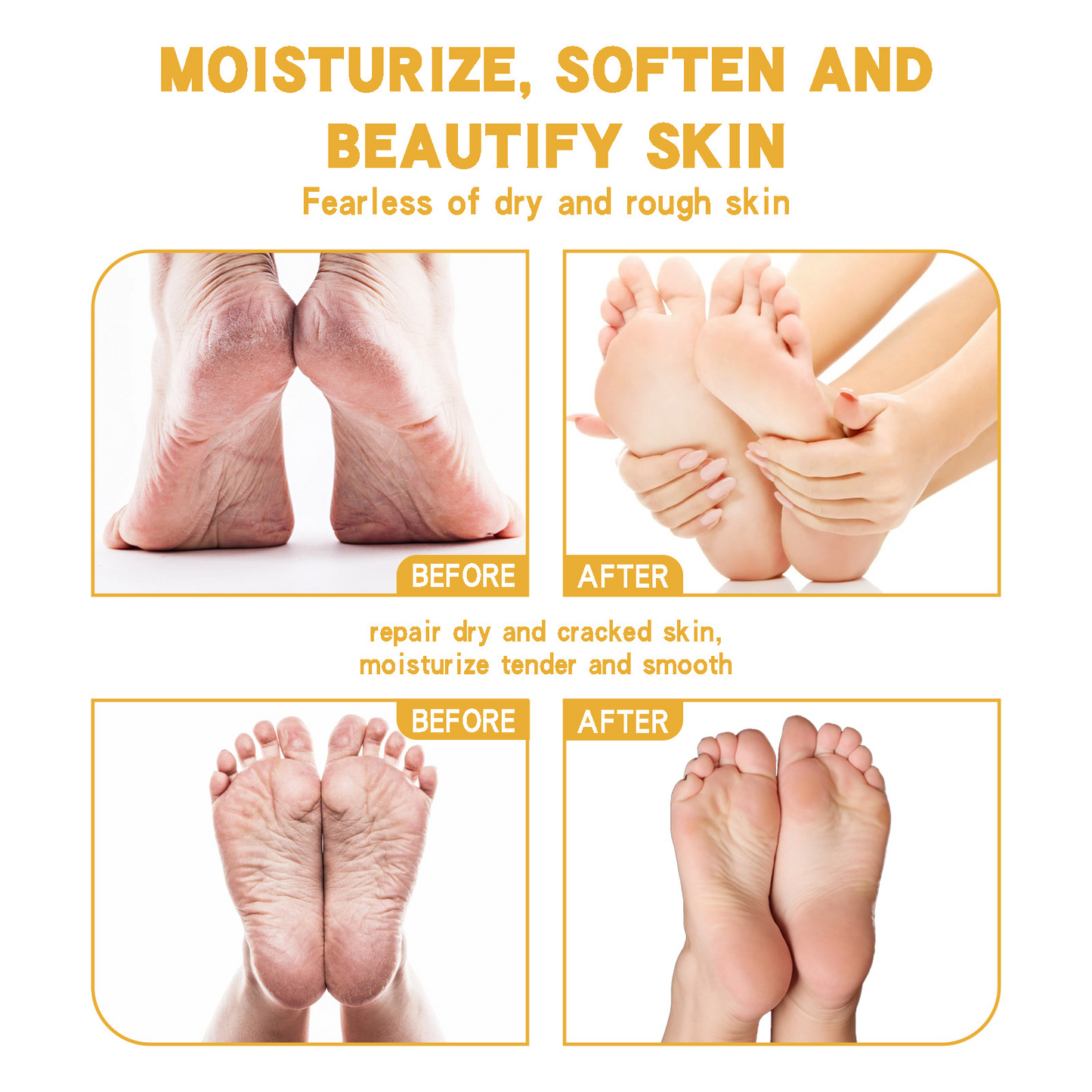 Crema Shurun para piel agrietada: hidratante y reparadora de grietas para el cuidado de los pies.