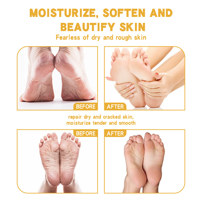 Crema Shurun para piel agrietada: hidratante y reparadora de grietas para el cuidado de los pies.