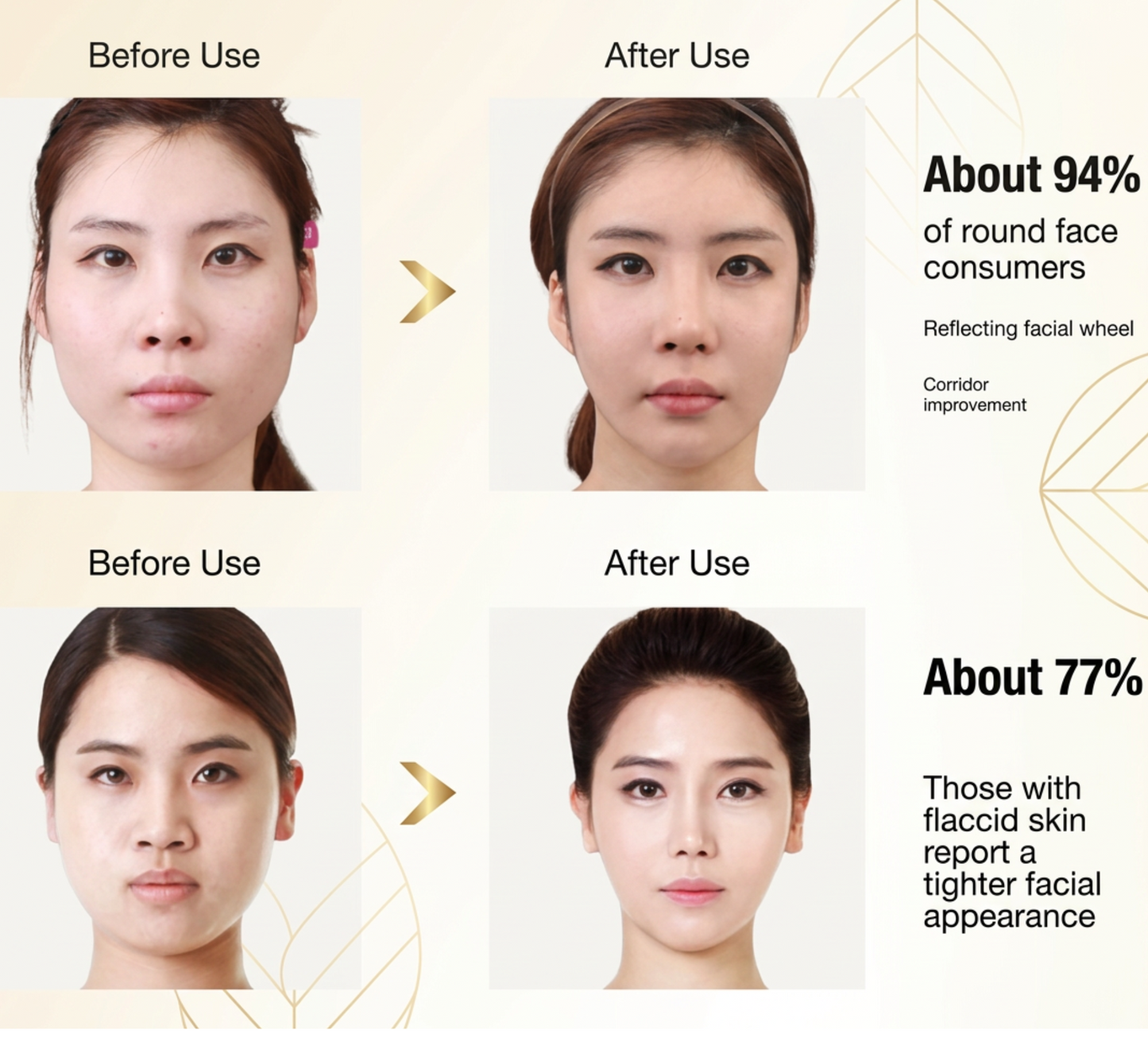 Dispositivo de Adelgazamiento Facial para el Contorno de Barbilla y Mandíbula.